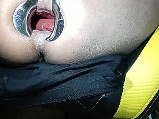 Deep analing with toy and speculum